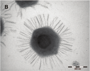 Electron micrograph of a Mimivirus